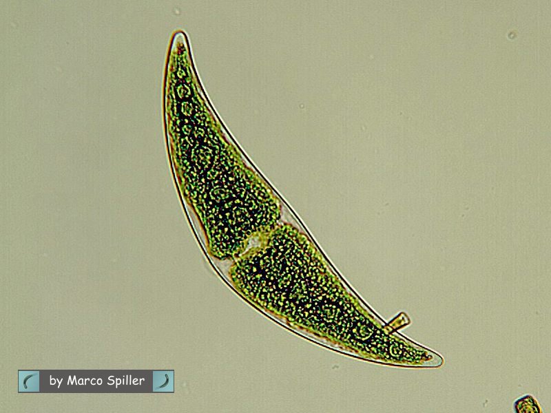 Closterium moniliferum: un''alga contro la radioattivit